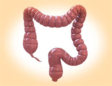 icd 10 code for diverticulitis|icd 10 diverticulosis unspecified.